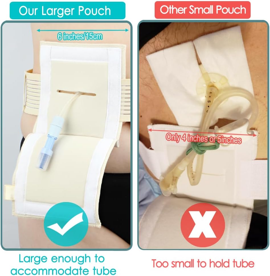 [2 Pack] Feeding Tube Belt, PEG Tube Holder G-Tube Protective Belt Breathable Beige with Slit for G Tube J Tube PEG Tube Supplies, No More Taping the Tube
